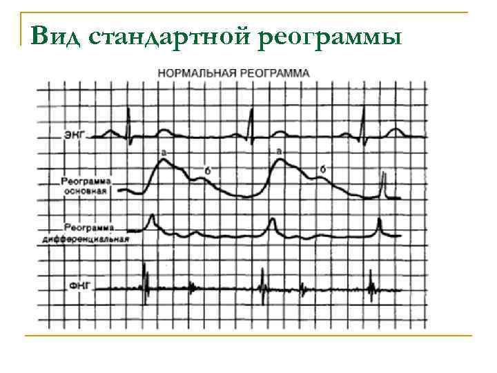 Вид стандартной реограммы Вид стандартной реограммы