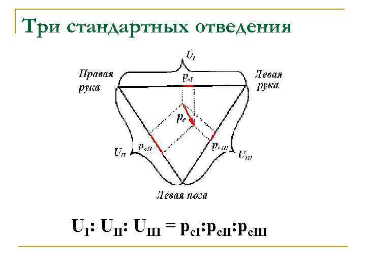 Три стандартных отведения UI: UIII = рс. I: рс. III Три стандартных отведения UI: UIII = рс. I: рс. III