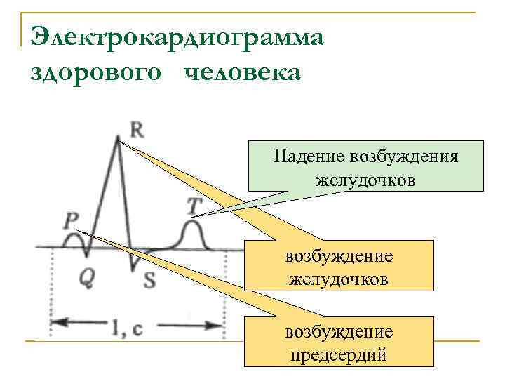 Электрокардиограмма здорового человека Падение возбуждения желудочков Электрокардиограмма здорового человека Падение возбуждения желудочков