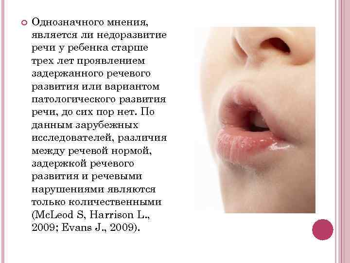   Однозначного мнения, является ли недоразвитие речи у ребенка старше трех лет проявлением