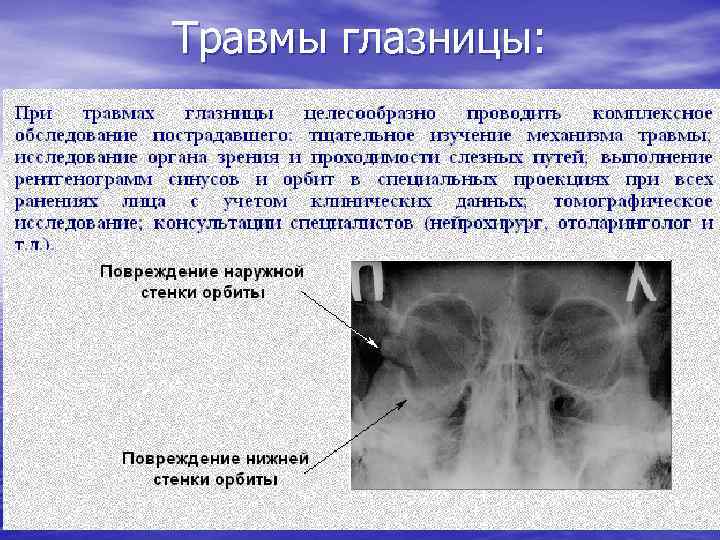 Травмы глазницы: 