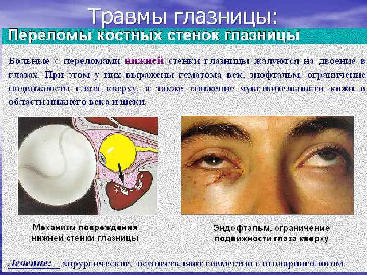 Травмы глазницы: 