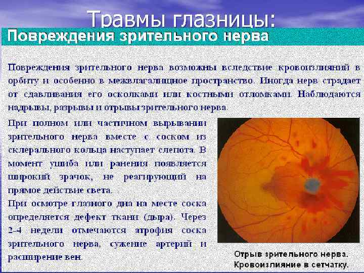 Травмы глазницы: 