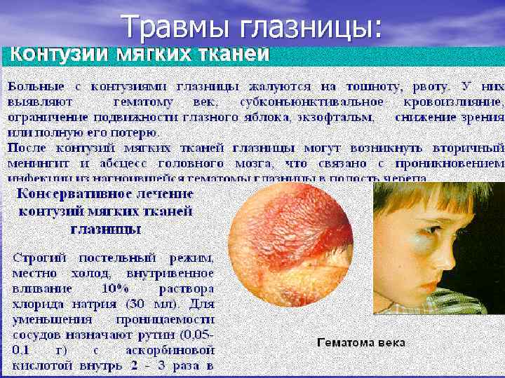 Травмы глазницы: 