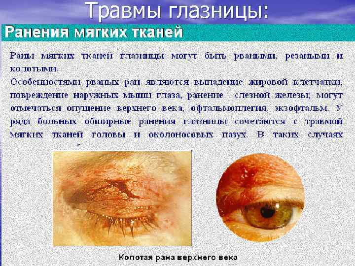 Травмы глазницы: 