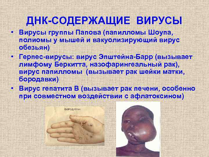   ДНК-СОДЕРЖАЩИЕ ВИРУСЫ • Вирусы группы Папова (папилломы Шоупа,  полиомы у мышей