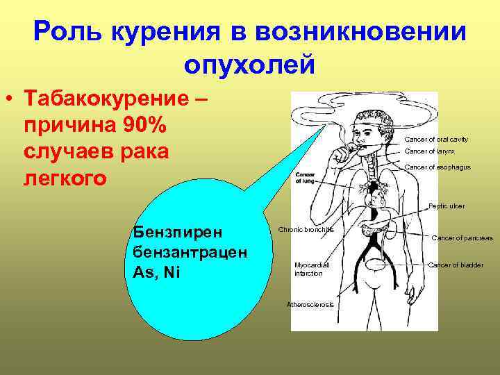  Роль курения в возникновении   опухолей • Табакокурение –  причина 90%