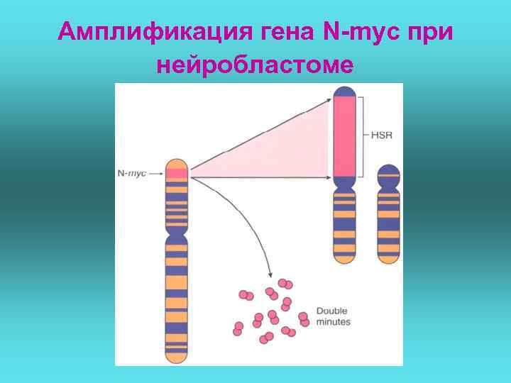 Амплификация гена N-myc при  нейробластоме 