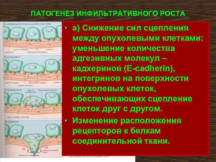 ПАТОГЕНЕЗ ИНФИЛЬТРАТИВНОГО РОСТА   • а) Снижение сил сцепления   между опухолевыми