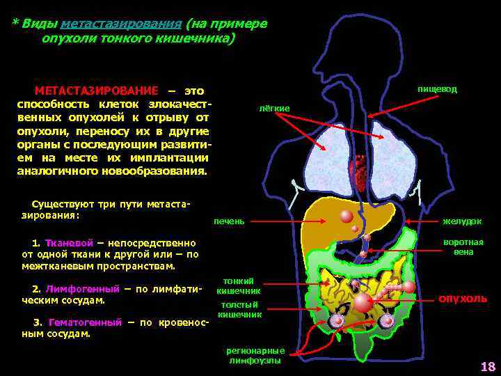 * Виды метастазирования (на примере опухоли тонкого кишечника)  МЕТАСТАЗИРОВАНИЕ – это  