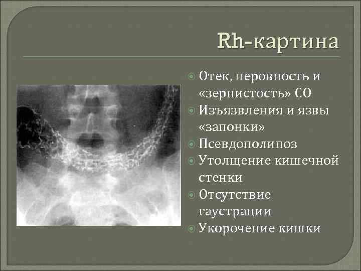 Гаустрация толстой кишки что это