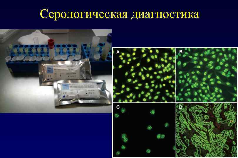 Серологическая диагностика 