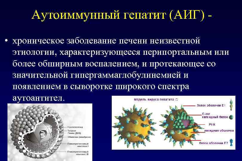  Аутоиммунный гепатит (АИГ) - • хроническое заболевание печени неизвестной  этиологии, характеризующееся перипортальным