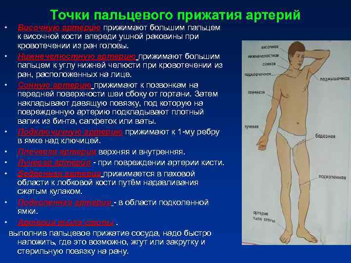 Места пальцевого прижатия артерий