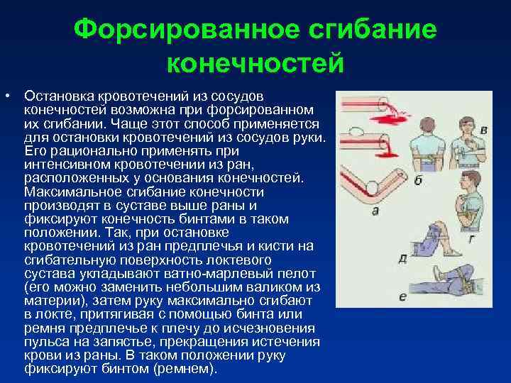 При кровотечении можно