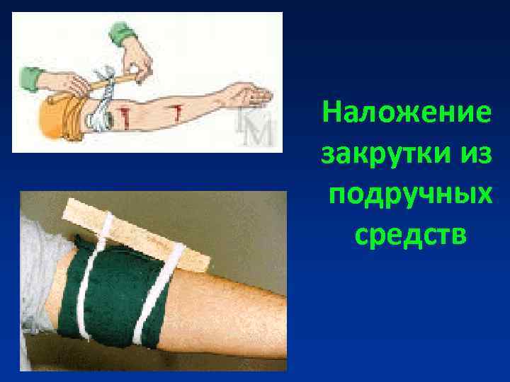 Наложение закрутки из подручных средств Наложение закрутки из подручных средств