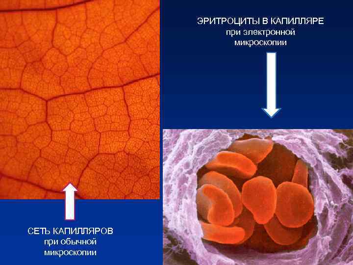 ЭРИТРОЦИТЫ В КАПИЛЛЯРЕ при электронной ЭРИТРОЦИТЫ В КАПИЛЛЯРЕ при электронной