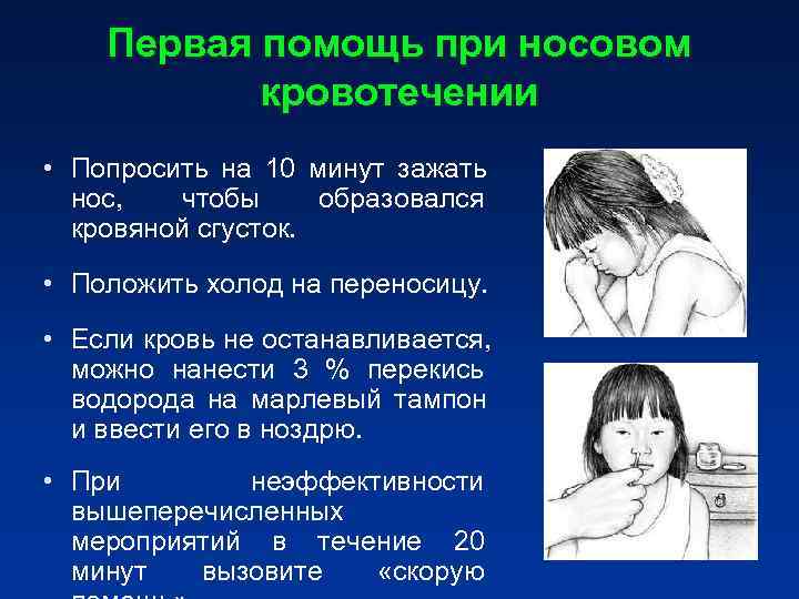 Первая помощь при носовом кровотечении • Попросить на 10 минут Первая помощь при носовом кровотечении • Попросить на 10 минут