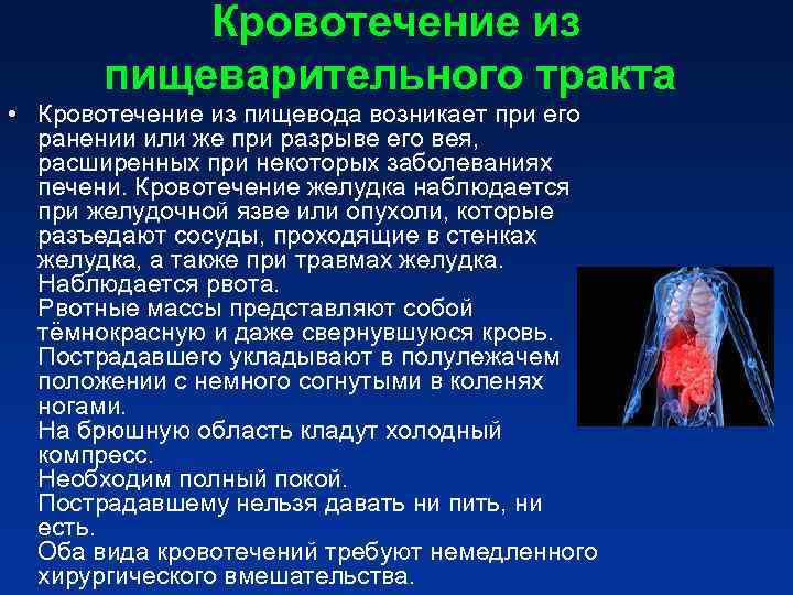 Кровотечение из пищеварительного тракта • Кровотечение из пищевода возникает Кровотечение из пищеварительного тракта • Кровотечение из пищевода возникает