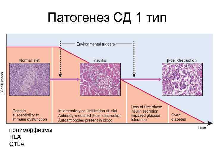 Патогенез СД 1 тип полиморфизмы HLA CTLA 