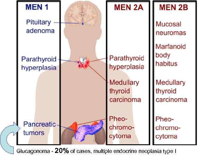 Glucagonoma - 20% of cases, multiple endocrine neoplasia type I 