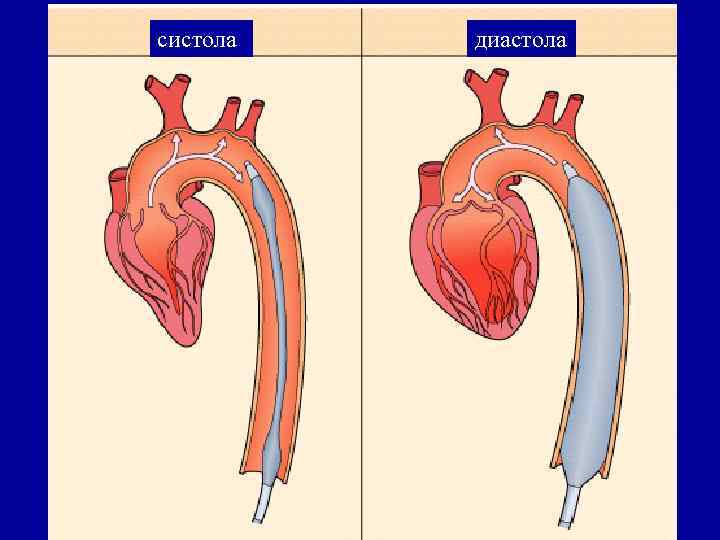 Систола и диастола рисунок