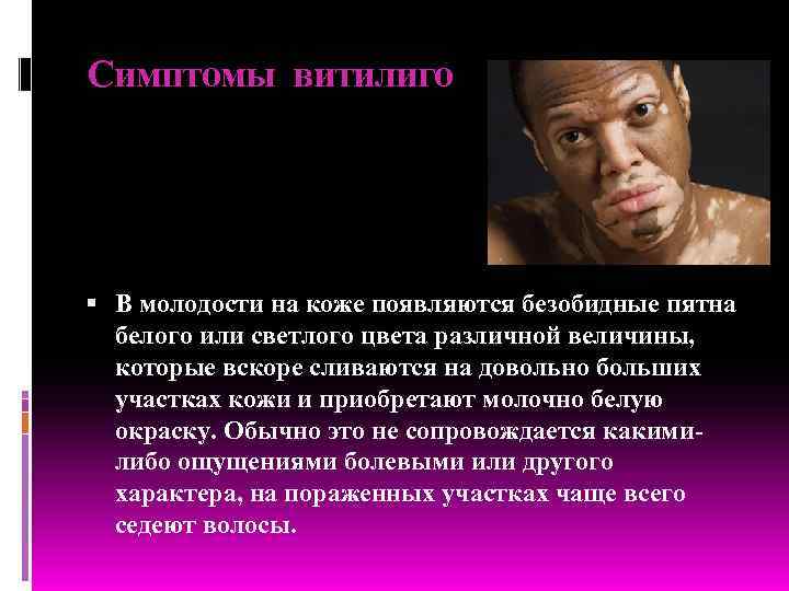 Симптомы витилиго  В молодости на коже появляются безобидные пятна  белого или светлого