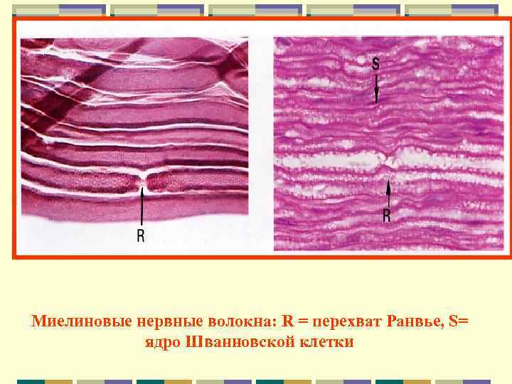 Рисунок миелиновые нервные волокна