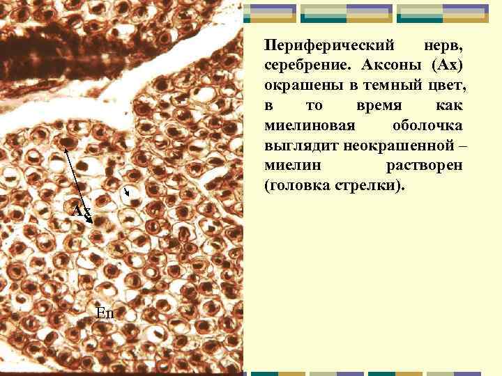    Периферический нерв,  серебрение. Аксоны (Ах)  окрашены в темный цвет,