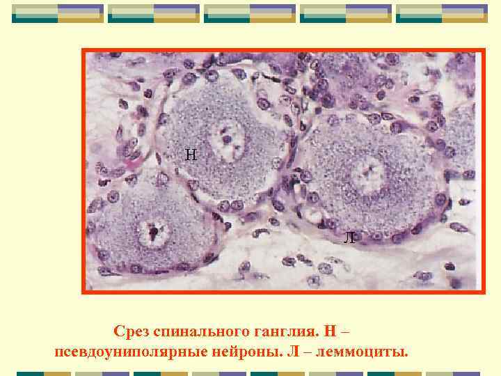     Н       Л  Срез