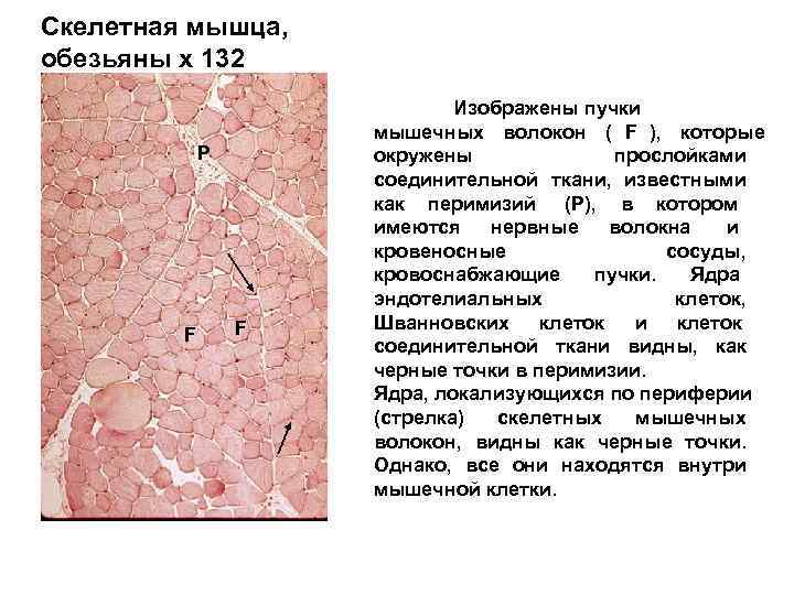 Скелетная мышца, обезьяны х 132     Изображены пучки   