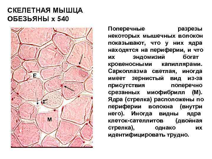 Скелетная мышечная ткань гистология рисунок