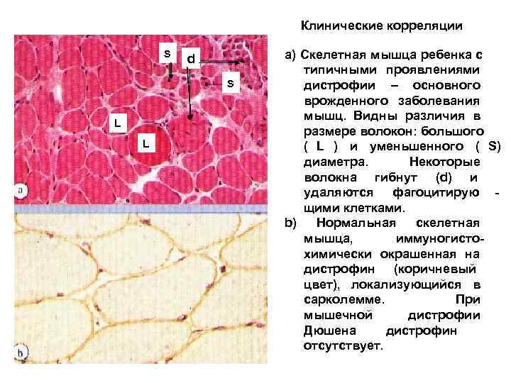      Клинические корреляции   s  d  а)
