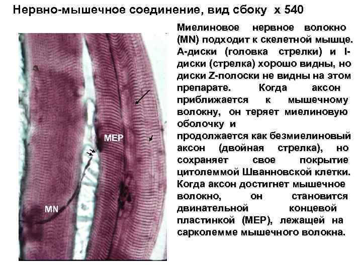 Нервно-мышечное соединение, вид сбоку x 540     Миелиновое нервное волокно 