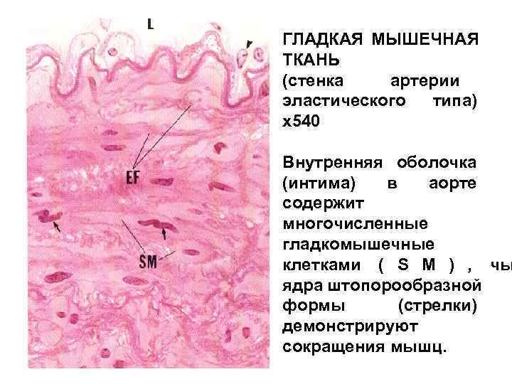 Стенка капилляра гистология