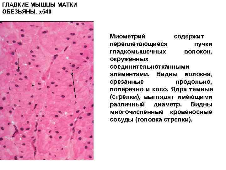 Гладкие мышцы