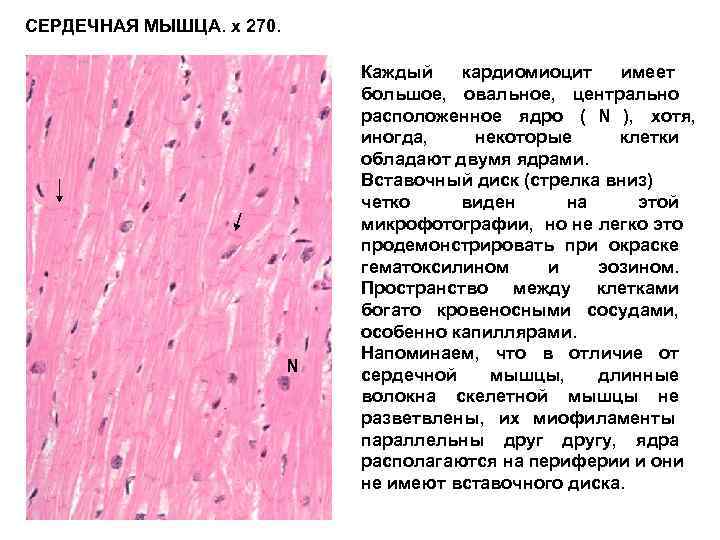 Сердечная мышечная ткань гистология рисунок