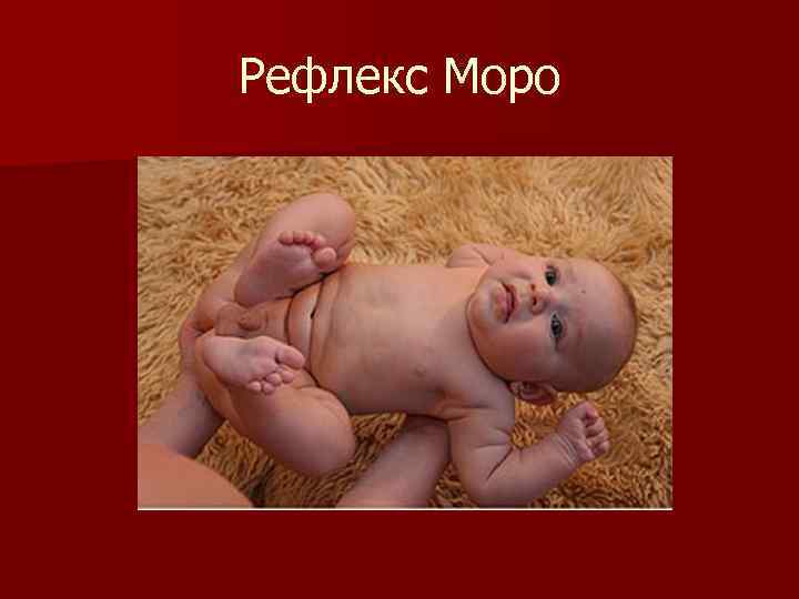 Рефлекс моро фото