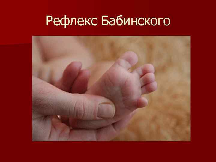 Рефлекс Бабинского Рефлекс Бабинского