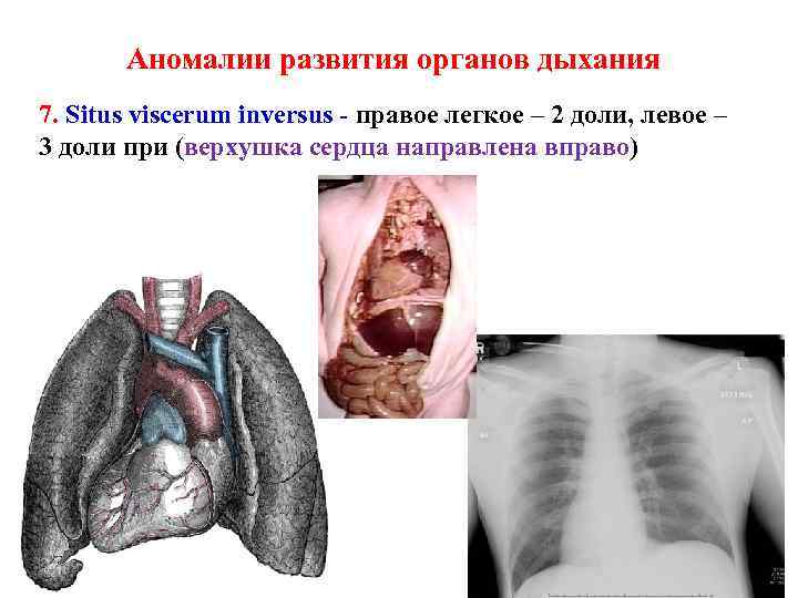 Фото увеличенных органов мужских