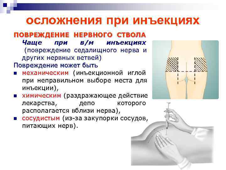 Причиной место. Осложнения при введении внутримышечной инъекции. Повреждение нервных стволов при инъекции. Внутримышечной инъекции место введения инъекций. Повреждение нервных стволов после внутримышечной инъекции.