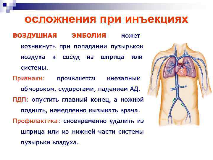 Воздушная эмболия при инъекции