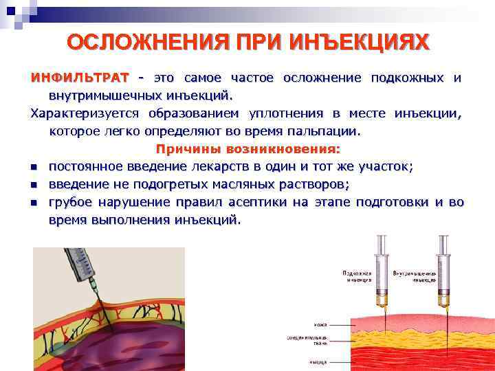 Через сколько попадает. Постинъекционные осложнения при проведении подкожных инъекций. Постинъекционные осложнения при внутримышечных инъекциях. Осложнения постановки подкожной инъекции. Неправильное Введение инъекций осложнения.