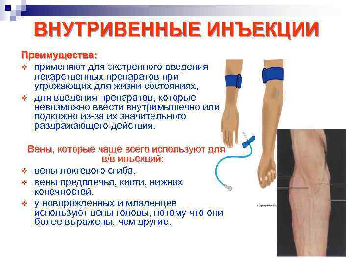 Внутривенные инъекции презентация