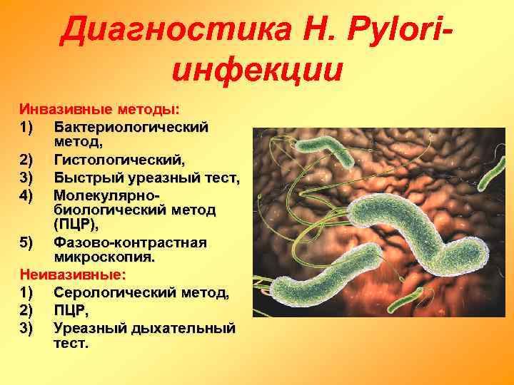   Диагностика H. Pylori-   инфекции Инвазивные методы: 1) Бактериологический метод, 2)