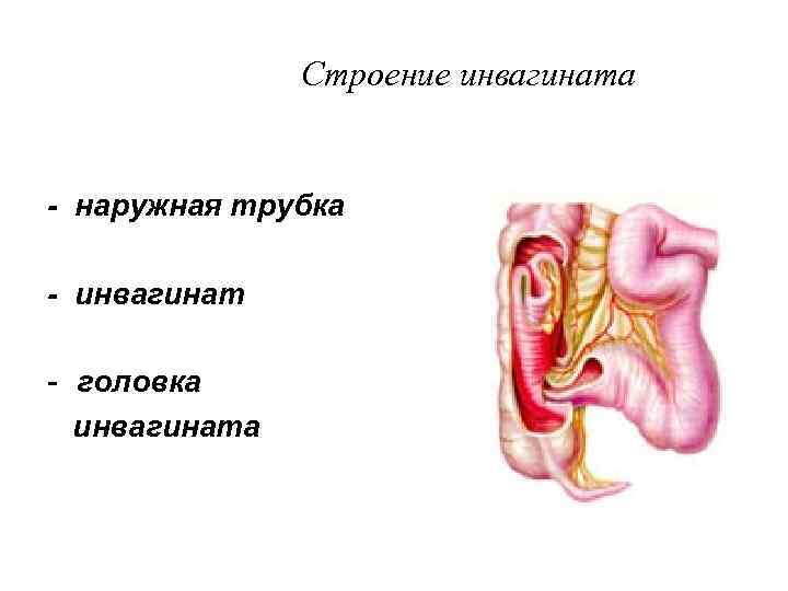     Строение инвагината  - наружная трубка - инвагинат - головка