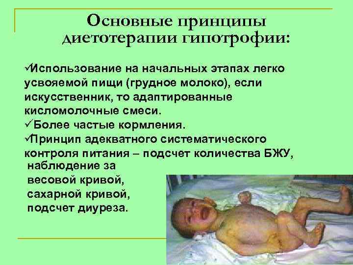   Основные принципы диетотерапии гипотрофии: üИспользование на начальных этапах легко усвояемой пищи (грудное
