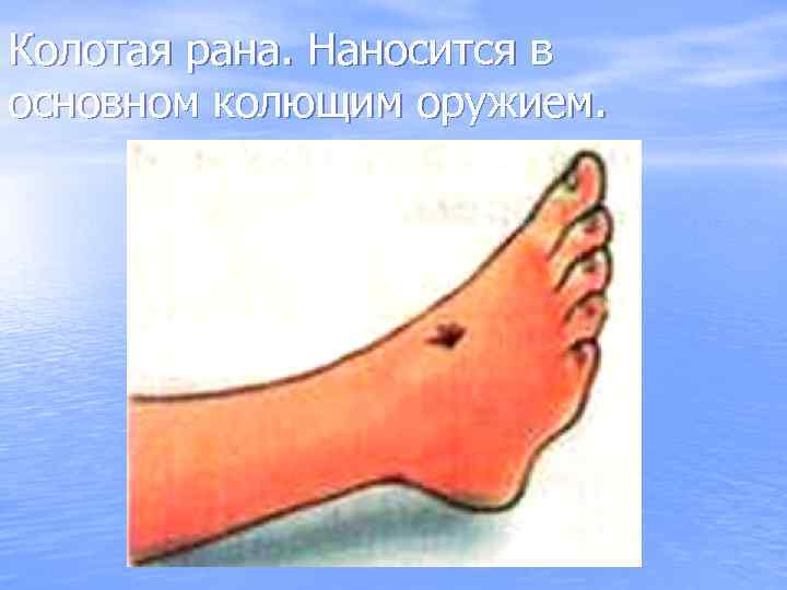 Колотая рана. Наносится в основном колющим оружием. 