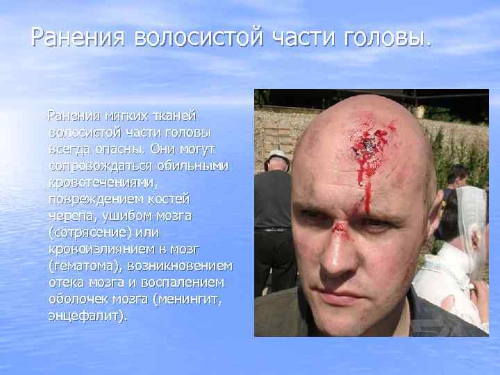 Ранения волосистой части головы. Ранения мягких тканей волосистой части головы всегда опасны. Они могут