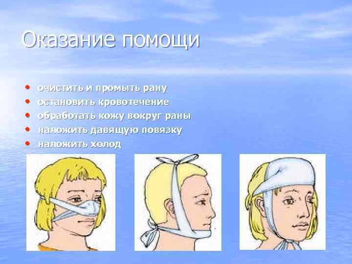 Оказание помощи  •  очистить и промыть рану •  остановить кровотечение •